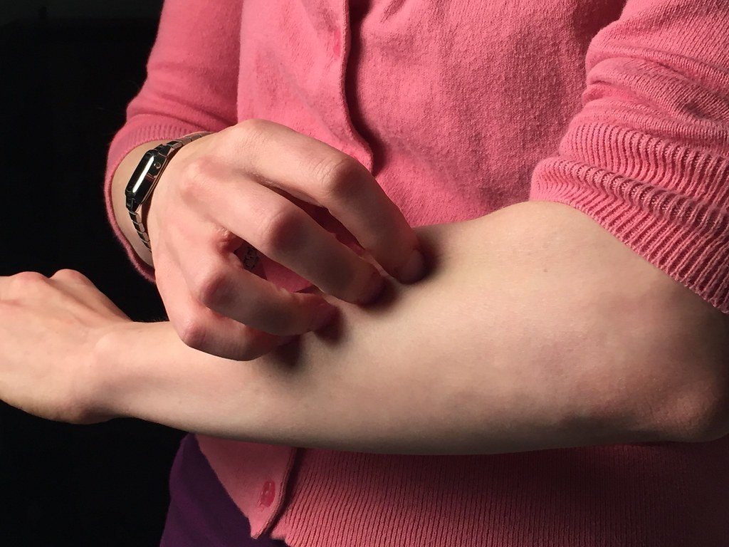 Human itching forearm