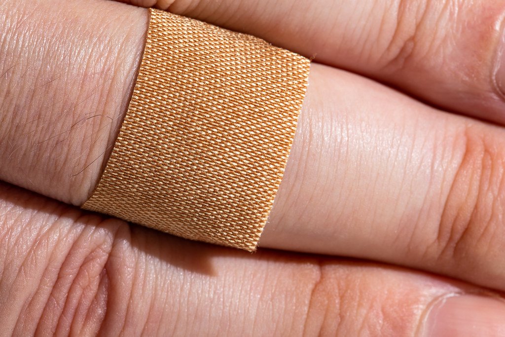 Cryosurgery on Hand