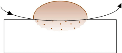 Mole Removal Diagram
