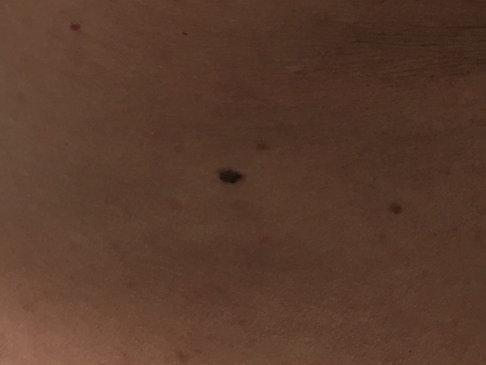 Six Preventative Steps For Avoiding Skin Cancer