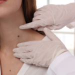 5 Signs You Might Need a Skin Cancer Screening