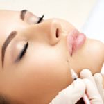 What You Should Know When Considering Botox