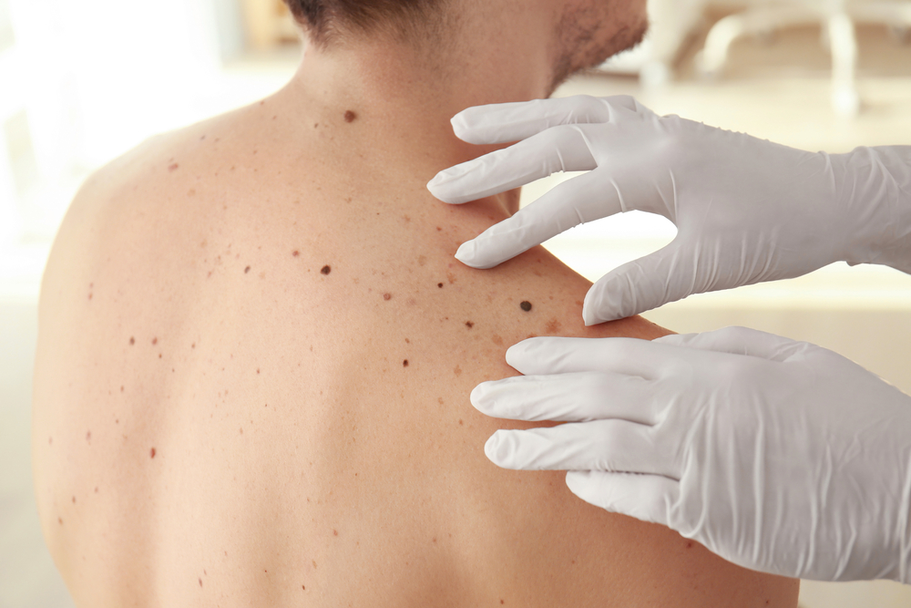 How Often Should I Go to the Dermatologist?