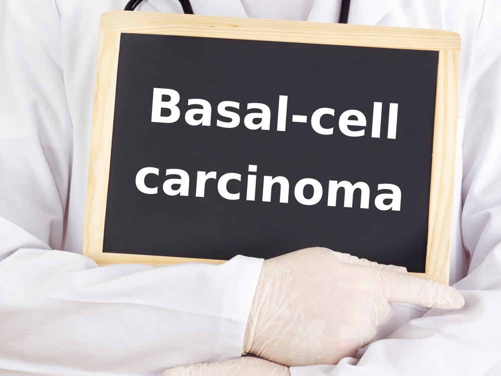 Basal Cell Carcinoma VS Other Carcinomas