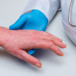 3 Major Differences Between Psoriasis and Eczema