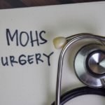 Things To Consider When Researching Mohs Surgery