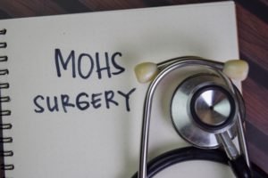Things To Consider When Researching Mohs Surgery