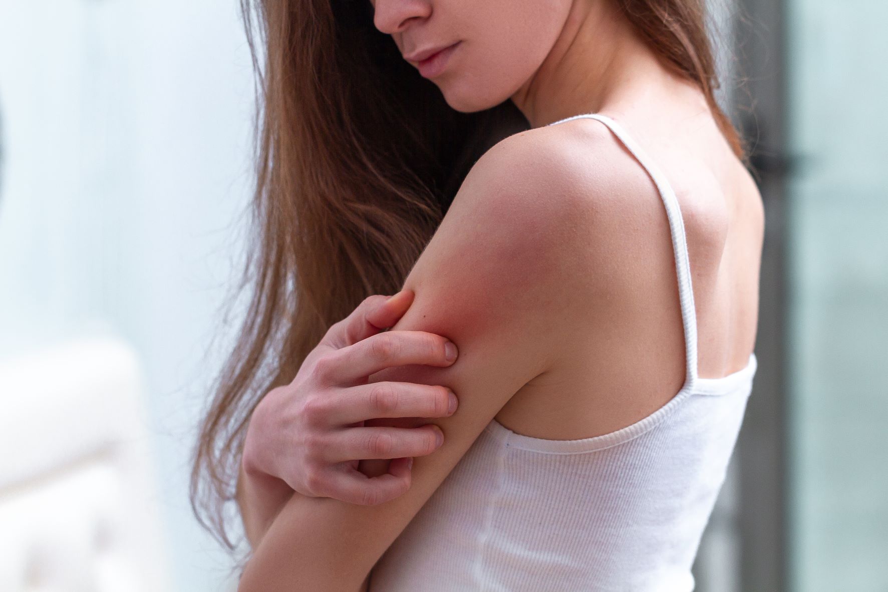 Rash Concerns: When to Choose to Contact a Professional