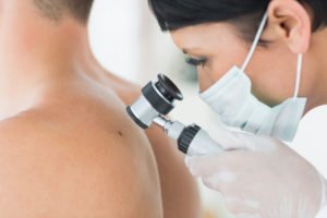 What Are Skin Checks, And How Often Do I Need To Do Them