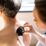 5 Signs You Should Have Your Mole Checked by a Dermatologist