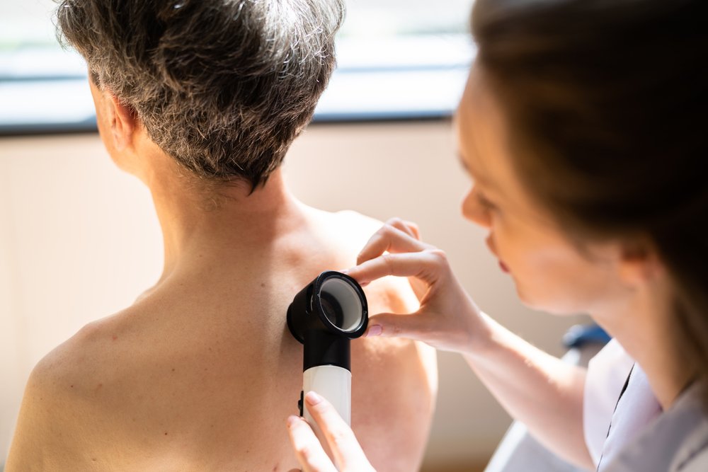 5 Signs You Should Have Your Mole Checked by a Dermatologist