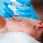 The Difference between Co2 Laser Resurfacing and Other Resurfacing Treatments