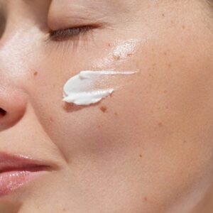 Can Over Moisturizing Cause Acne?