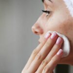 How to Treat Acne After Accutane