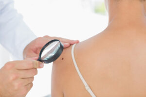 What Dermatology Procedures Are Covered by Insurance?