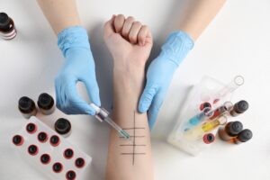 How Long Does Allergy Testing Take