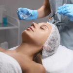 Your First Chemical Peel: What to Expect and How to Maximize Results Without Downtime