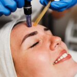 Microneedling for Fine Lines and Wrinkles: How Soon Will You See Results?