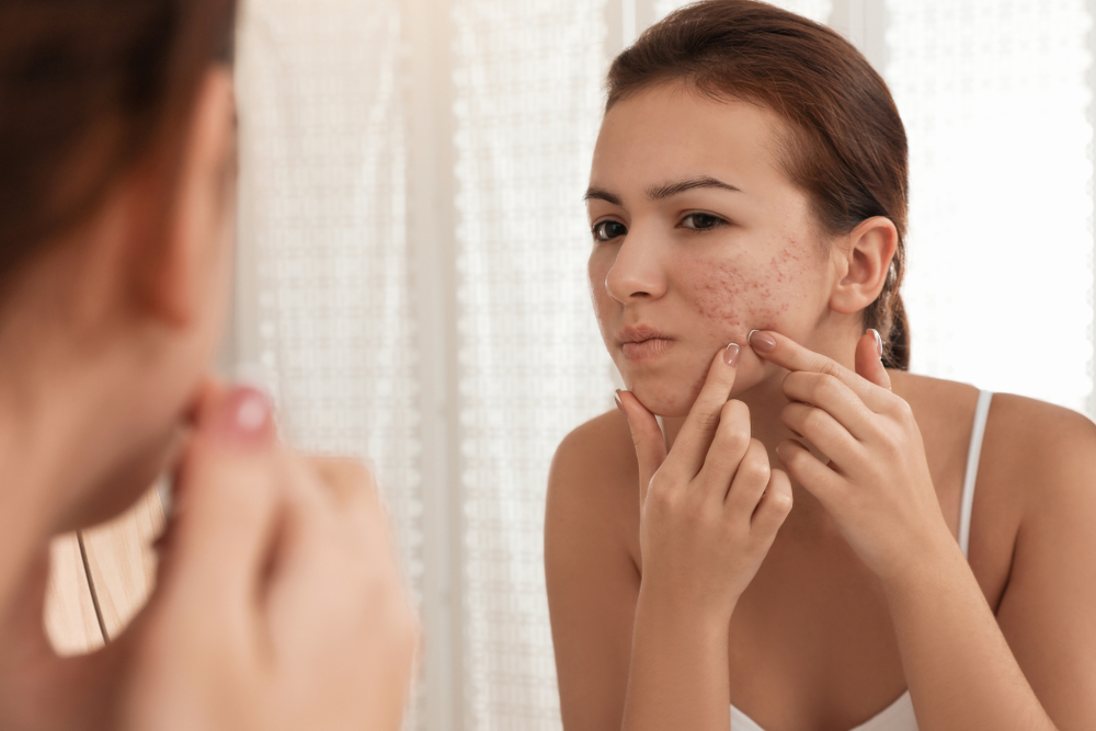 The Hidden Impact of Stress on Your Skin: Managing Flare-Ups from Within
