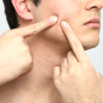 Men’s Skin Care Myths & Musts: A Dermatologist’s Guide
