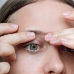 Cyst Removal: Why You Should Never Try to Pop It Yourself