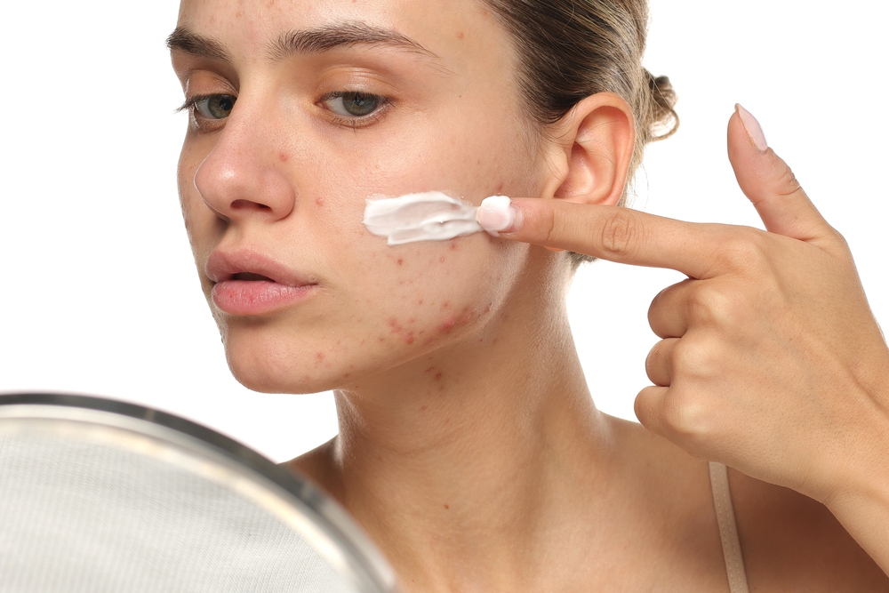Effective Acne Scar Removal: How to Get Rid of Acne Scars Without Laser Treatment