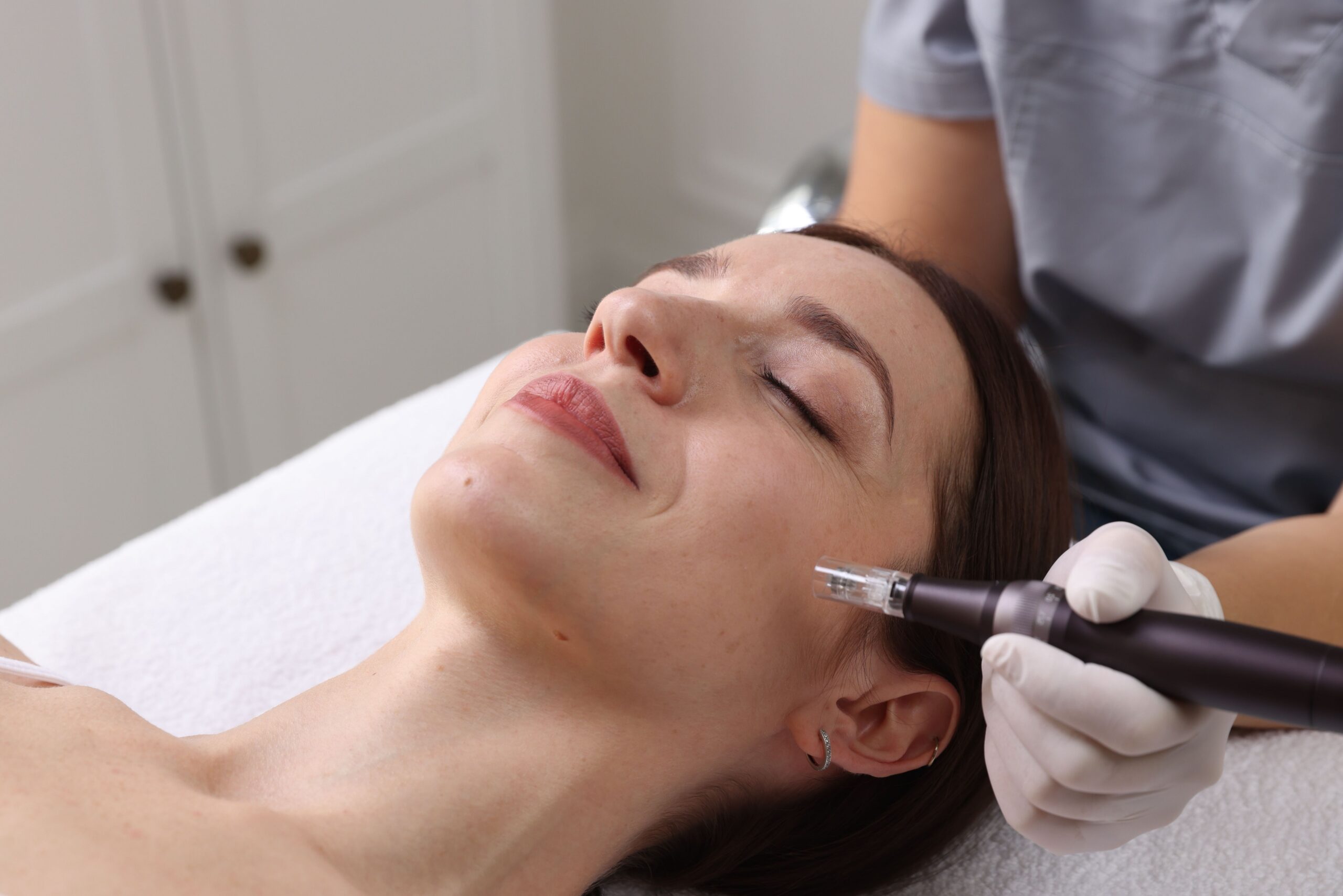 RF Microneedling vs. Traditional Microneedling: Choosing The Option For Your Skin